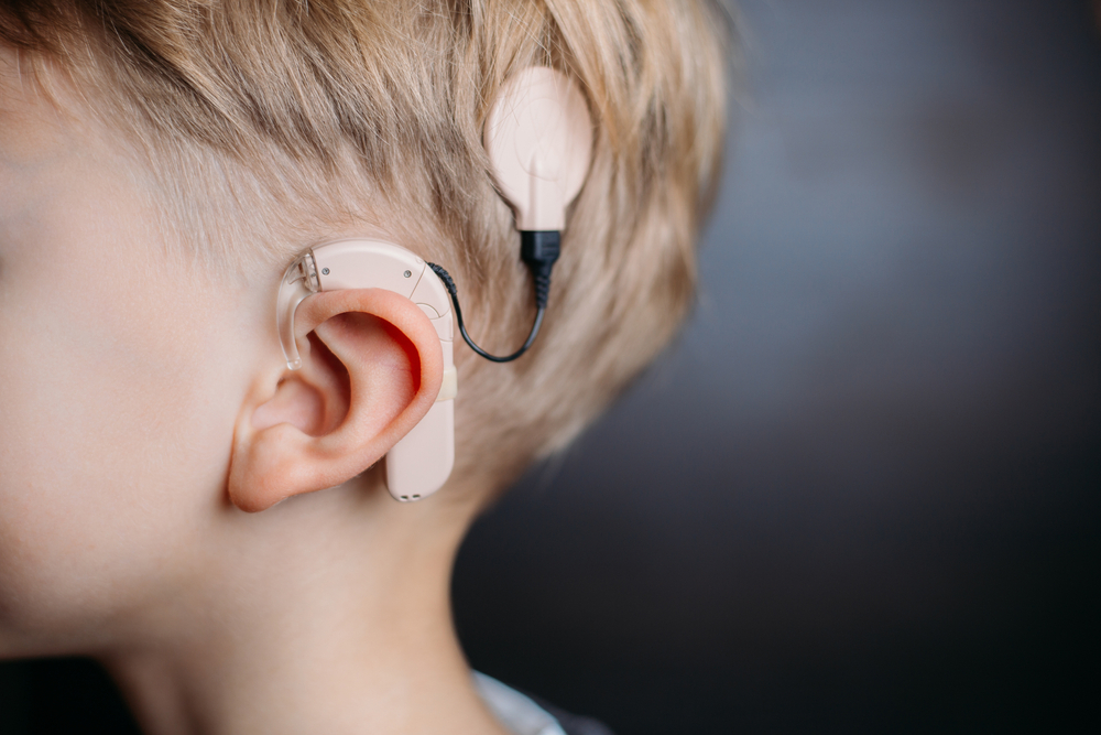 Cochlear Implant in Pune | Cochlear Implant Surgery in Pune